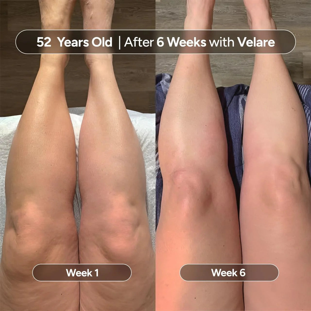 Velare Anti-Cellulite Massage Oil