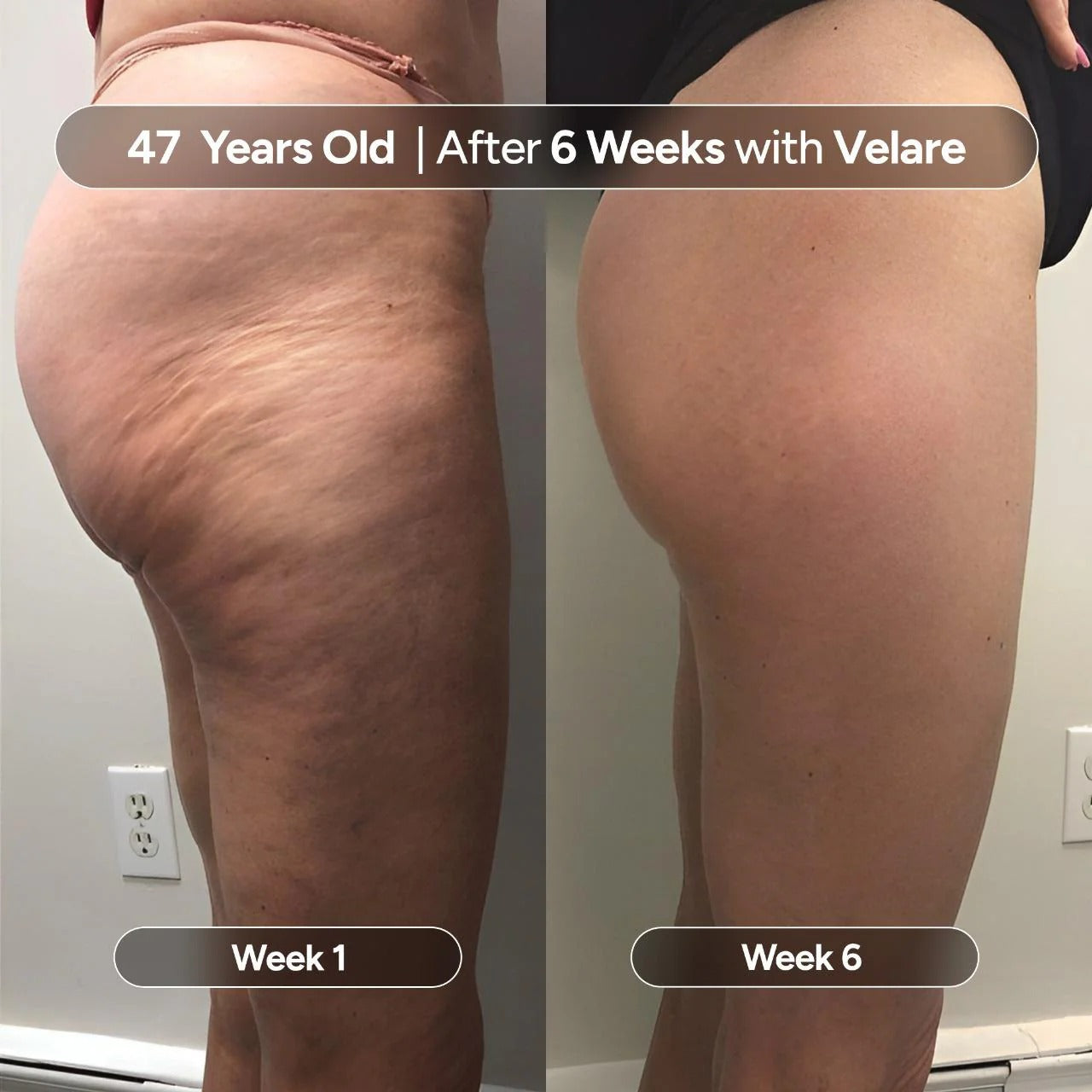 Velare Anti-Cellulite Massage Oil